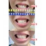 7 Days Whitening Teeth Kit 美白牙仪